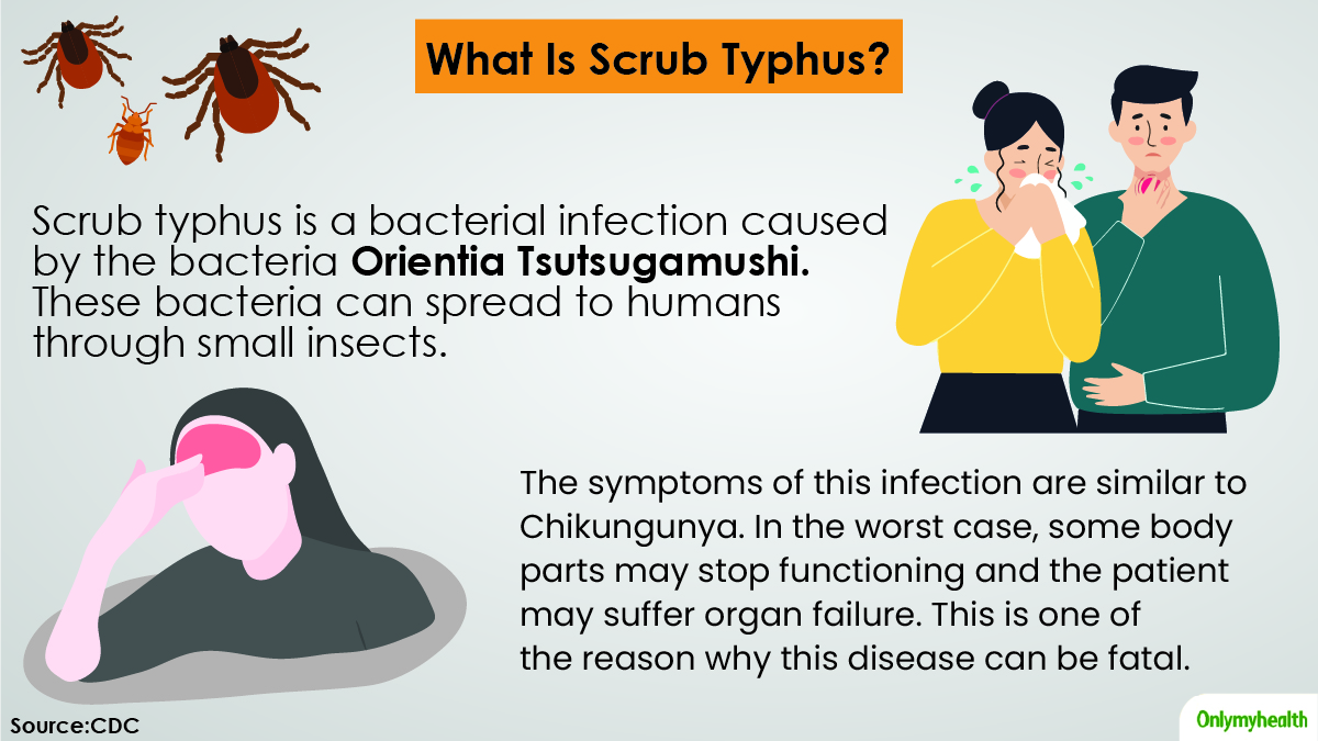 India On Alert As Scrub Typhus Claims 14 Lives, Here’s Everything You